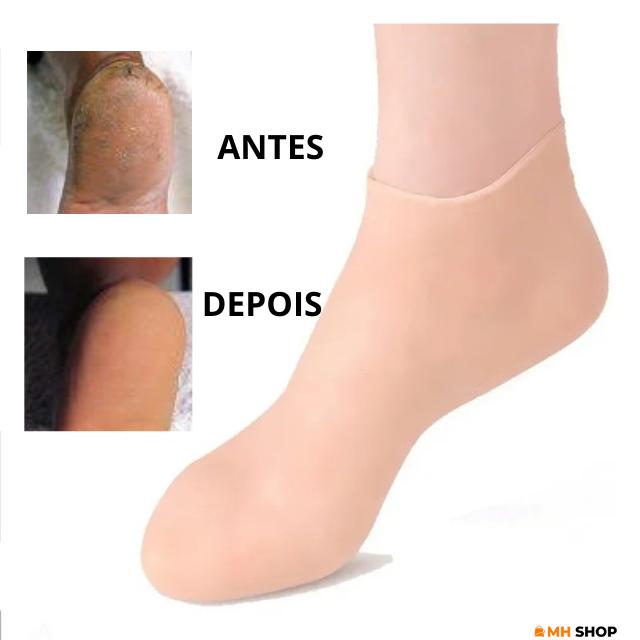 Hidrata Max™ - Meias hidratantes de silicone [ELIMINA TODAS AS RACHADURAS]